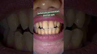 Dental Spa di Klinik Parakita yuk Cabang Talasapang atau Cabang Perintis ya [upl. by Arlena196]