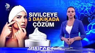 Sivilceye karşı 3 dakikada kesin cözüm [upl. by Franci]