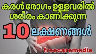 Liver disease symptoms malayalam [upl. by Eelanej]