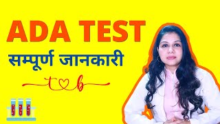 Adenosine Deaminase Test Procedure in Hindi  ADA Test क्या होता हैं कैसे होता हैं [upl. by Antonino480]