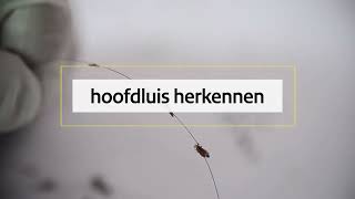 Hoofdluis herkennen [upl. by Mou]