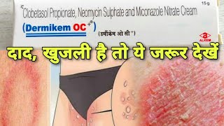 Dermikem OC crem दाद खाज ओर खुजली को जङ से मिटाने के लिए फंगल इन्फेमेस्किन इन्फेमे Medicine [upl. by Cecile67]