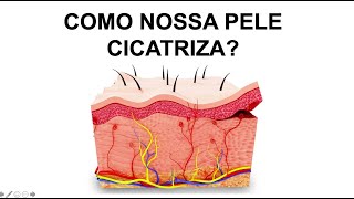 COMO OCORRE A CICATRIZAÇÃO NA PELE Por Luiz Gameiro dermatologista [upl. by Ayanaj]