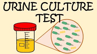 URINE CULTURE TEST  HOW TO COLLECT URINE SAMPLE [upl. by Santoro]