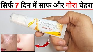 Melacare Cream Review in Hindi मेलाकेयर क्रीम के फायदे नुकसान उपयोग [upl. by Aerdnas]