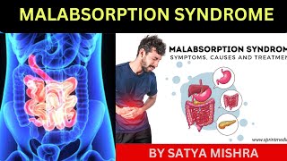 Malabsorption Syndrome  child health Nursing Online Nursing Classes  Easy Explanation in Hindi [upl. by Yraeg221]