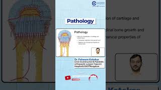 Pathology by Dr Faheem Kotekar  Orthopedic Residency  Conceptual Orthopedics [upl. by Daht]