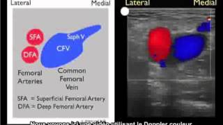 Comment  Étude de cas sur la détection dune thrombose veineuse 1 [upl. by Jacklin]