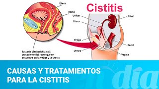 114 Cistitis diagnóstico y tratamiento [upl. by Namad]