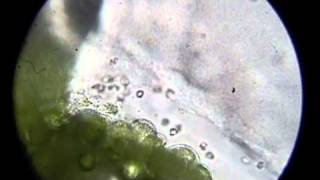 Ceratopteris gametophytes and sperm [upl. by Nylirrej]