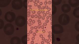 Malaria parasite 😱science pathology biology shortvideo dmlt viral tranding malariaparasites [upl. by Blayze]