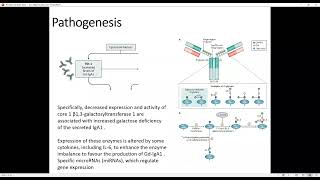 Basics of Renal Pathology  IgA Nephropathy [upl. by Onailimixam135]