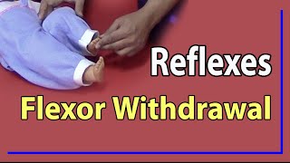 01 Flexor Withdrawal Reflex [upl. by Nuarb]